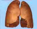 non smokers lung