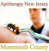 Апитерапия, лечение пчелоужалениями, Monmouth County, New Jersey